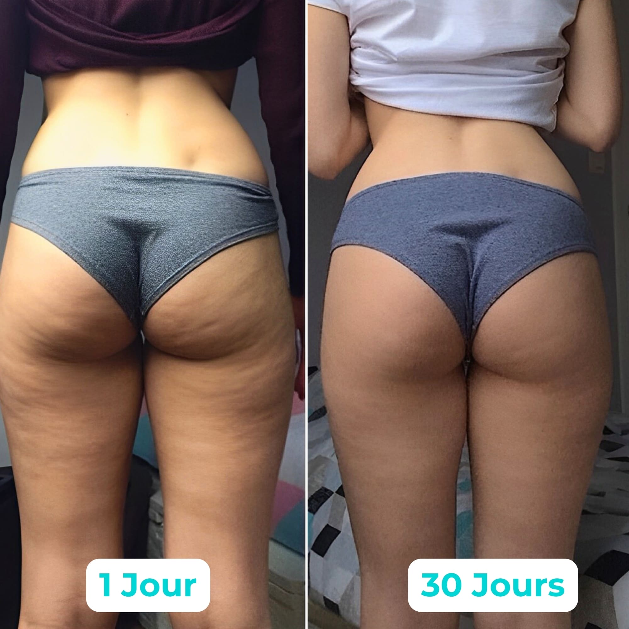 Vibraskin® - Améliore l'apparence de la peau