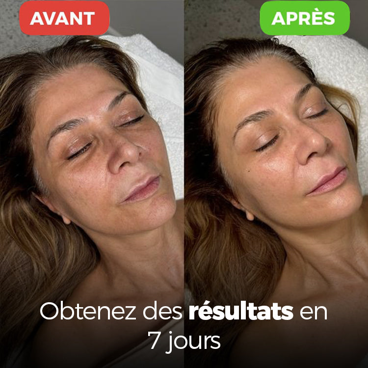 Aquapure - Améliore l'apparence de la peau